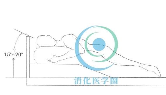 打嗝多、胃灼热、胸痛，最容易被误诊的健康杀手找上你了吗？