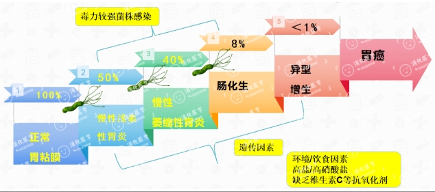 体检中心用金山胶囊内镜找到胃癌高危因素！专家建议防胃癌要趁早